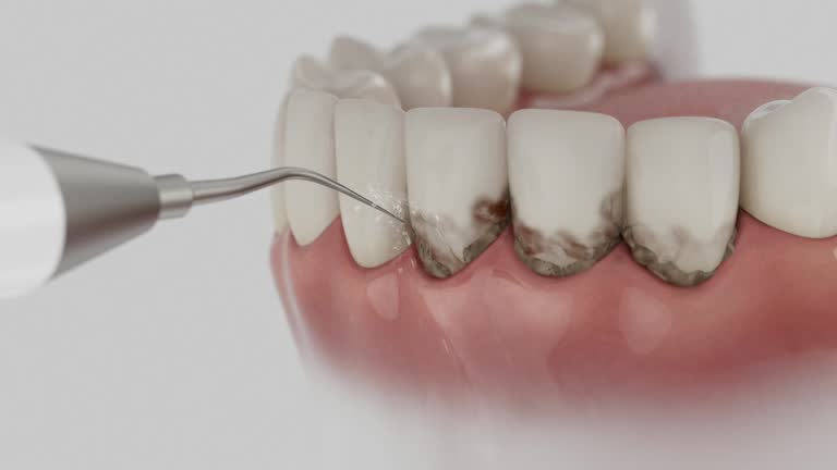 Trusted Tooth Extraction service in Bellevue, KY - Dentist Open Now